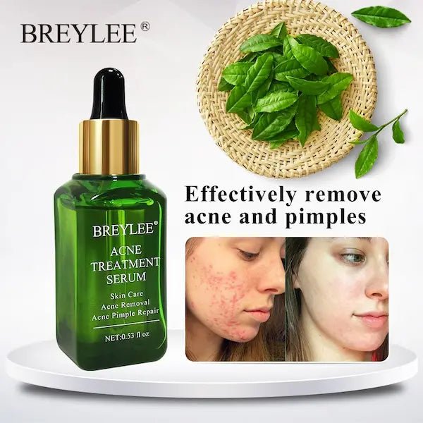 Acne Treatment & Scar Repair Serum – Plant-Powered Blemish Essence