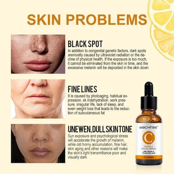 Vitamin C Facial Firming Essence 30ml | Burford Glow